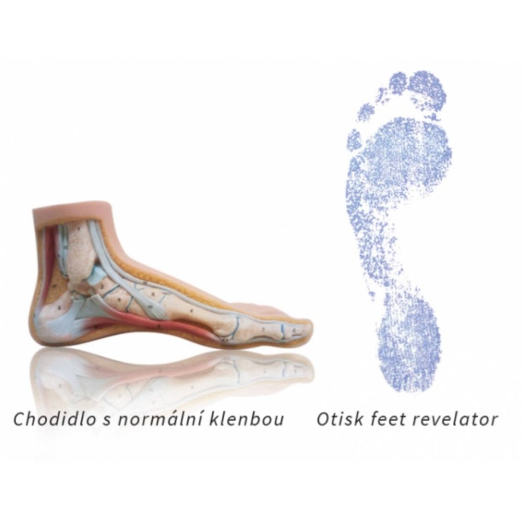 Orthopädische Hilfsmittel Sidas Winter 3Feet Mid